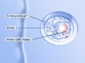 胚胎著床強化-胚胎黏著劑 (EmbryoGlue)